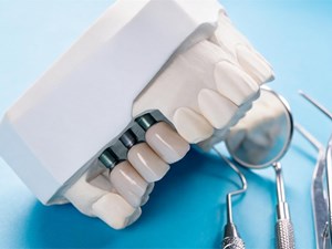 6 pasos del proceso de osteointegración que debe conocer