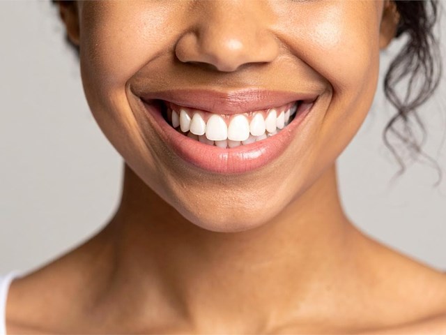 Cómo mantener sus dientes blancos después de un blanqueamiento