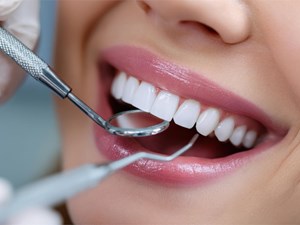 ¿Cómo prevenir y tratar el sarro subgingival?