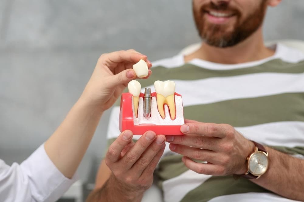¿Cuáles son los mejores implantes dentales? Diferencias y ventajas