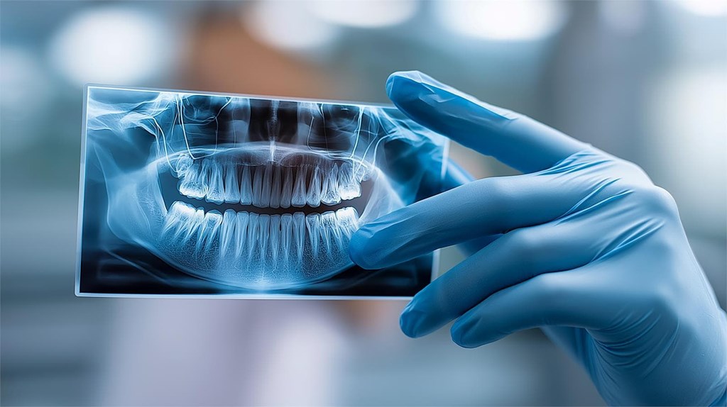 ¿Cuándo es indispensable la radiografía para un diagnóstico?