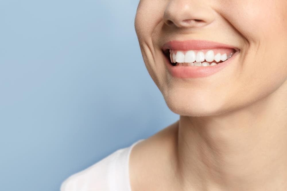 ¿Cuándo se notan los resultados de un blanqueamiento dental? 