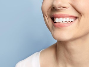 ¿Cuándo se notan los resultados de un blanqueamiento dental? 