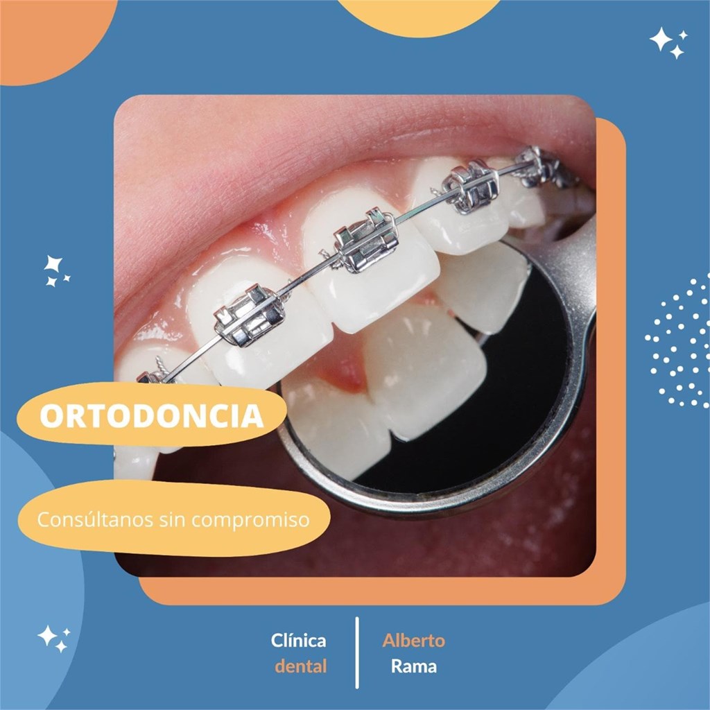¿Cuántos tipos de ortodoncia existen?