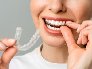 ¿Es Invisalign una opción válida para mí?