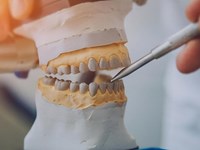 Mitos y verdades sobre la estética de las prótesis dentales modernas