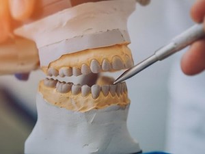 Mitos y verdades sobre la estética de las prótesis dentales modernas