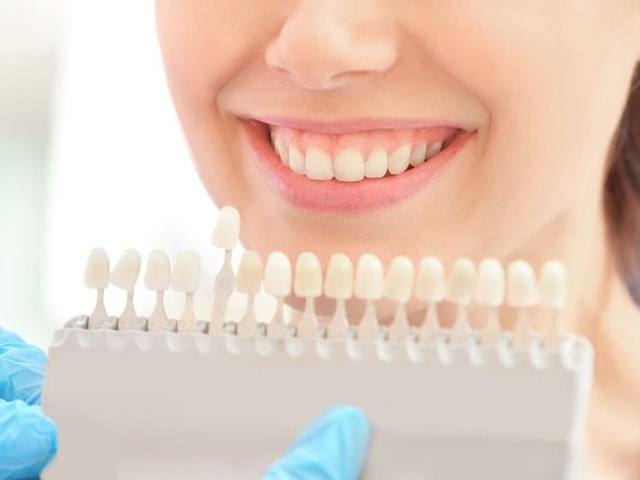 Principales beneficios del blanqueamiento dental