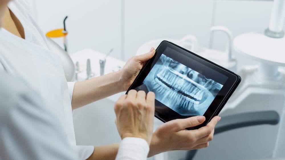 ¿Qué es la radiología digital? ¿Para qué sirve?