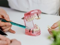 Qué hacer si se le cae un implante dental: pasos a seguir