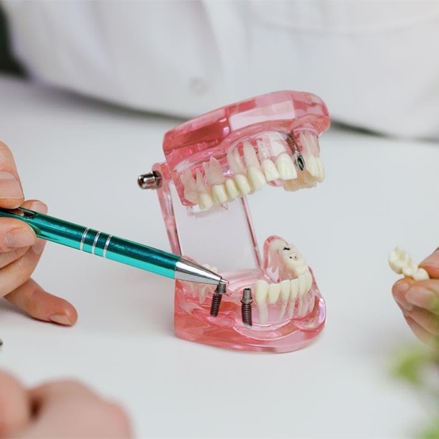 Qué hacer si se le cae un implante dental