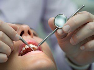 ¿Qué hacer si un empaste se cae o se daña?
