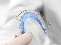 Tiempo de media de los tratamientos de ortodoncia